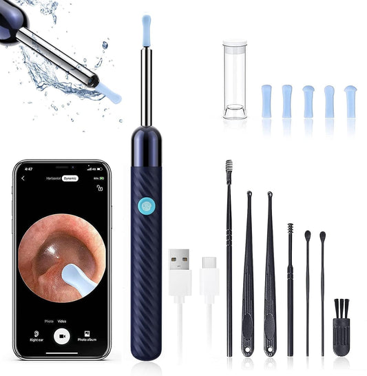 AuriVue Ear Cleaning Kit – 1080P HD Camera with LED, WiFi, Android & iOS